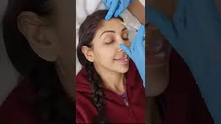 Will BOTOX Freeze your face? Let's test! Dr V xx