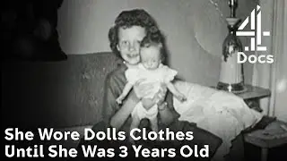 Meet a Woman Who Wore Dolls Clothes Until She Was 3-Years-Old