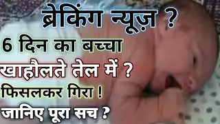 खाहौलते तेल में गिरा मासूम बच्चा|| child || kids news|| hadsha news|| children News|| fare news