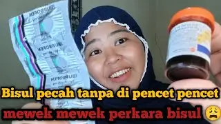Obat bisul & salep bisul terbaik | bisul cepet pecah tanpa di pencet pencet