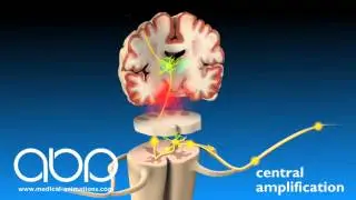 Pain - Central Amplification