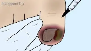 ASMR merawat kuku cantengan