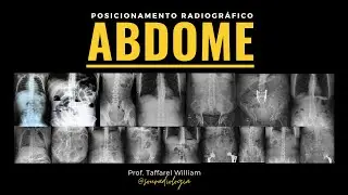 Radiografias de Abdome- Identificando a Colelitiase
