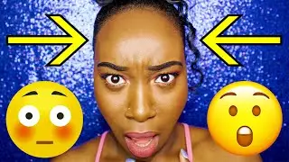 BIG FOREHEAD STRUGGLES  😭