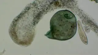 Amoeba vs stentor compilation part 1... to Alan Parsons; Edgar Winter; and Genesis