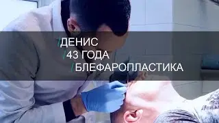 Я хочу открытый взгляд! Блефаропластика век