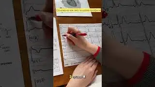 ECG analysis. Calculating heart rate.