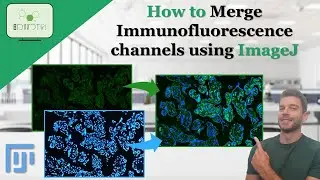 How to Merge different Immunofluorescence channels using ImageJ #immuno #channels #imagej