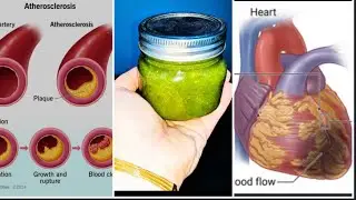 This sauce will open clogged arteries in a month| Healthy Green chutney recipe @RoyalDesiFood