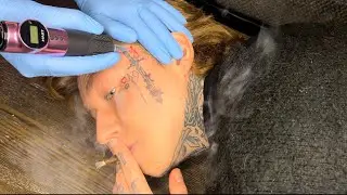 GETTING A FACE TATTOO WHILE STONED