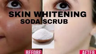 Skin Whitening soda Scrub || LOTUS BOTANICAL SODA SCRUB HONEST REVIEW #skinwhitening #blackheads