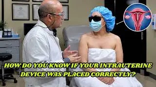 How Do You Know If Your Intrauterine Device Was Placed Correctly? | Dr Gustavo