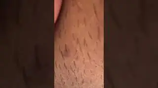 snake cat very dangerous 