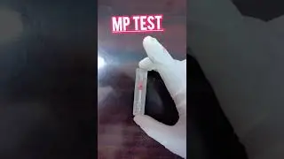 mp test // Malaria test #Malaria #youtubeshorts #girishchandra blood test