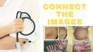 CLINCH IT !! Connect  these images #medico   #imagebasedquestion #medicine