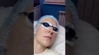 Лазерное удаление сосудов