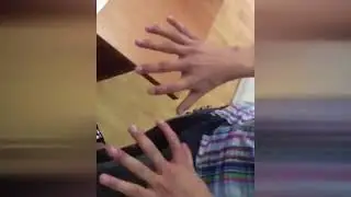 6 Пальцев на руке