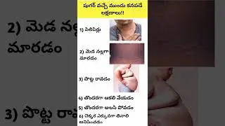 షుగర్ వచ్చే ముందు కనపడే లక్షణాలు