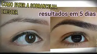 FAÇA SUA SOBRANCELHA CRESCER EM 5 DIAS E CORRIJA AS FALHAS