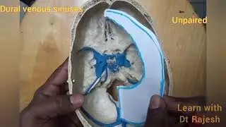 DURAL FOLDS and DURAL VENOUS SINUSES - Overview