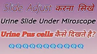 How to adjust slide on microscope | Pus cells under microscope | Pus cells in urine