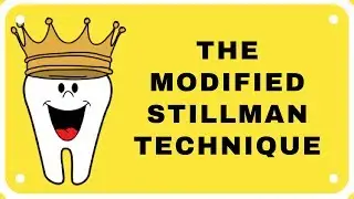 Modified Stillman Technique