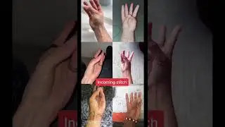 You're definitely not an alien if you have this tendon! 