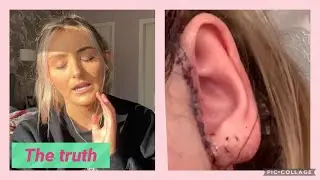 THE TRUTH ABOUT MY LIFE | MY JOURNEY WITH TMJ
