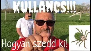 Hogyan szedd ki a kullancsot a kutyádból! (Random Vágatlanul)