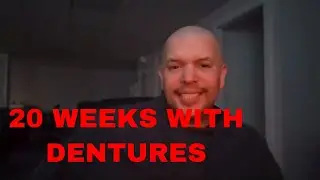 20 Weeks in w/ Immediate Dentures (RECAP)