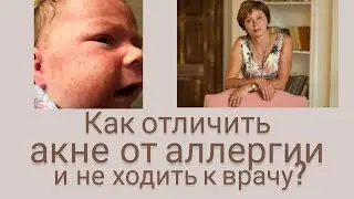 Как отличить акне от аллергии и не ходить к врачу?