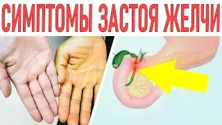 СИМПТОМЫ ЗАСТОЯ ЖЕЛЧИ. Чем опасна холестаза и что делать при застое желчи