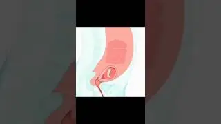 Expansion Of Uterus During Pregnancy 😶
