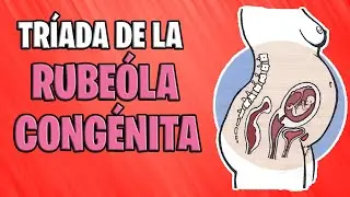 ✅ CONGENITAL RUBEOLA | GREGG TRIAD [EASY] 