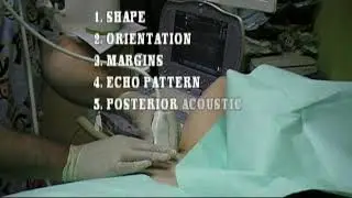 BREAST LUMP ULTRASOUND