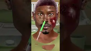 ASMR Infected Face Animation 💉