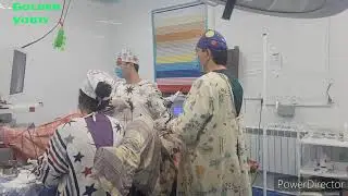 Экстирпация матки