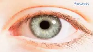 Things Your Eyes Are Trying To Tell You About Your Health