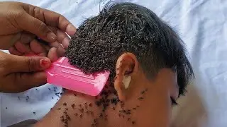 estou com coceira na cabeça..