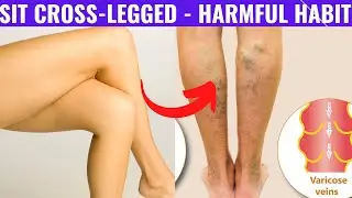 Habit of Sitting Cross-Legged- Varicose Veins and 5 Serious Harms