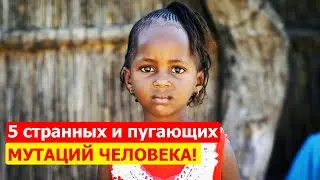 5 наиболее СТРАННЫХ и ПУГАЮЩИХ человеческих мутаций!