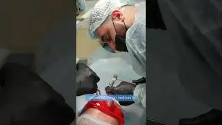 Синус-лифтинг + имплантация в Лёгкой стоматологии 