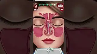 brain surgery #shorts #asmr #youtubeshorts #viral #short