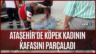 Another Stray Dog Horror / Dog Torn Woman's Head Apart in Ataşehir