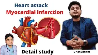 heart attack kaise hota hai  | heart attack ke lakshan kya hai | heart attack se kaise bche