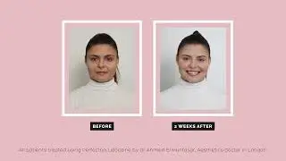 Introducing Perfectha®