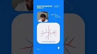 Восстановление зуба 4.7. Погребневая методика #реставрациязуба #реставрация #стоматология