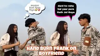 Hand Burn Prank🔥❤️‍🔥 ll Prank On Boyfriend (Gone Emotional 😭)