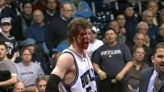 CRAZY BASKETBALL INJURIES(BLOODY)