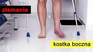 Złamanie kostki bocznej